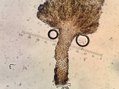 Chaenothecopsis pusilla