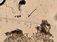 Chaenothecopsis pusilla
