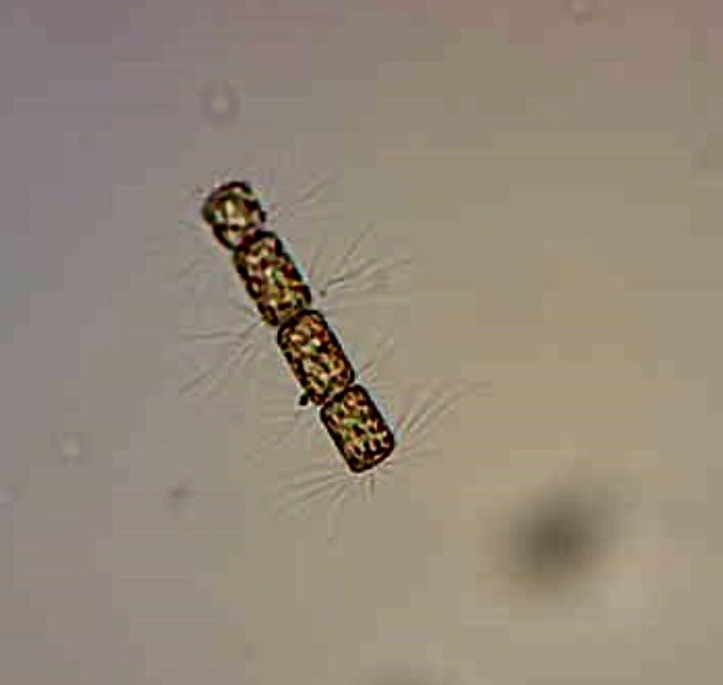 Bacteriastrum delicatulum