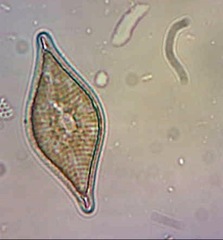 Rhaphoneis amphiceros