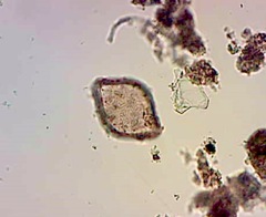 Zygoceros rhombus
