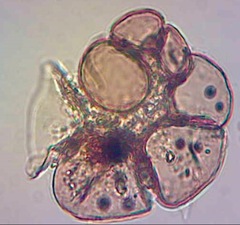 Foraminifera
