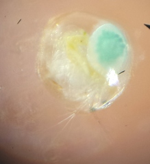 Chydoridae