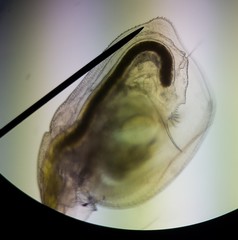 Simocephalus