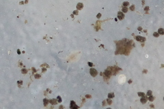Simocephalus