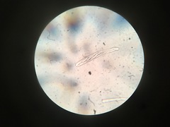 Trichopeziza