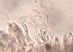 Trichopeziza