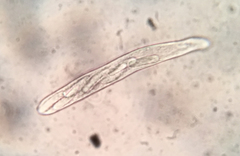 Trichopeziza