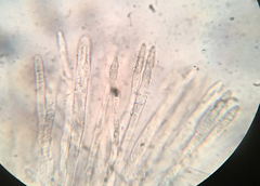 Trichopeziza