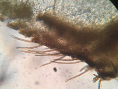 Trichopeziza