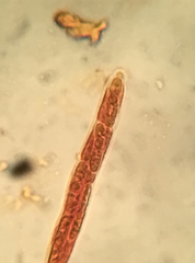 Trichopeziza