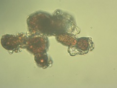 Trentepohlia umbrina