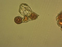 Trentepohlia umbrina