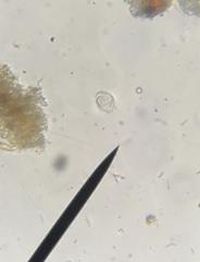Strombidium