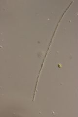 Anabaena