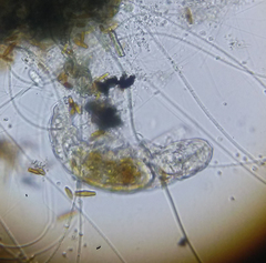 Tardigrada