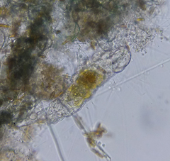 Tardigrada