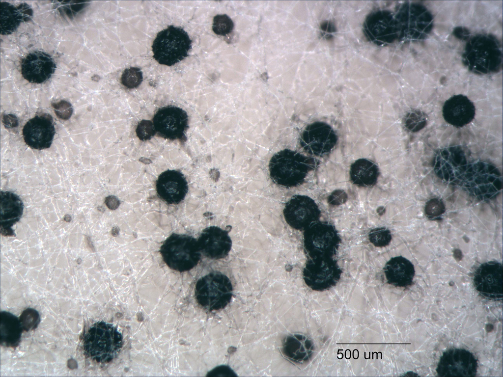 Neurospora endodonta