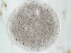 Actinosphaerium