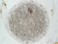 Actinosphaerium