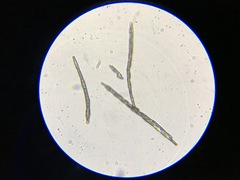 Trichoglossum hirsutum image
