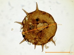 Centropyxis aculeata