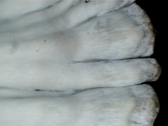 Cymatoderma elegans image