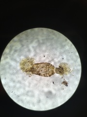 Entoprocta