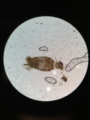 Entoprocta