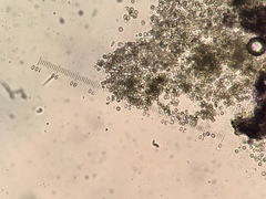 Lichenoconium pyxidatae
