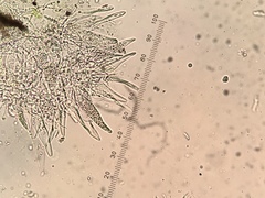 Thelocarpon laureri