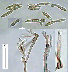 Pleurotheciopsis