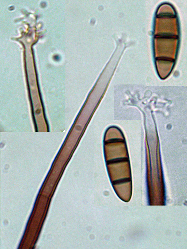 Pleurothecium leptospermi image