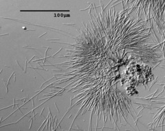 Polyscytalum ciliatum