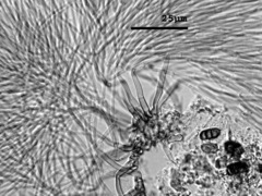 Polyscytalum ciliatum