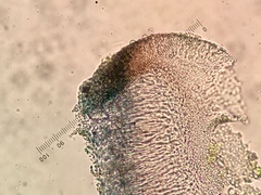 Bacidia circumspecta