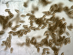 Sporocadus lichenicola
