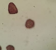 Fossombronia wondraczekii