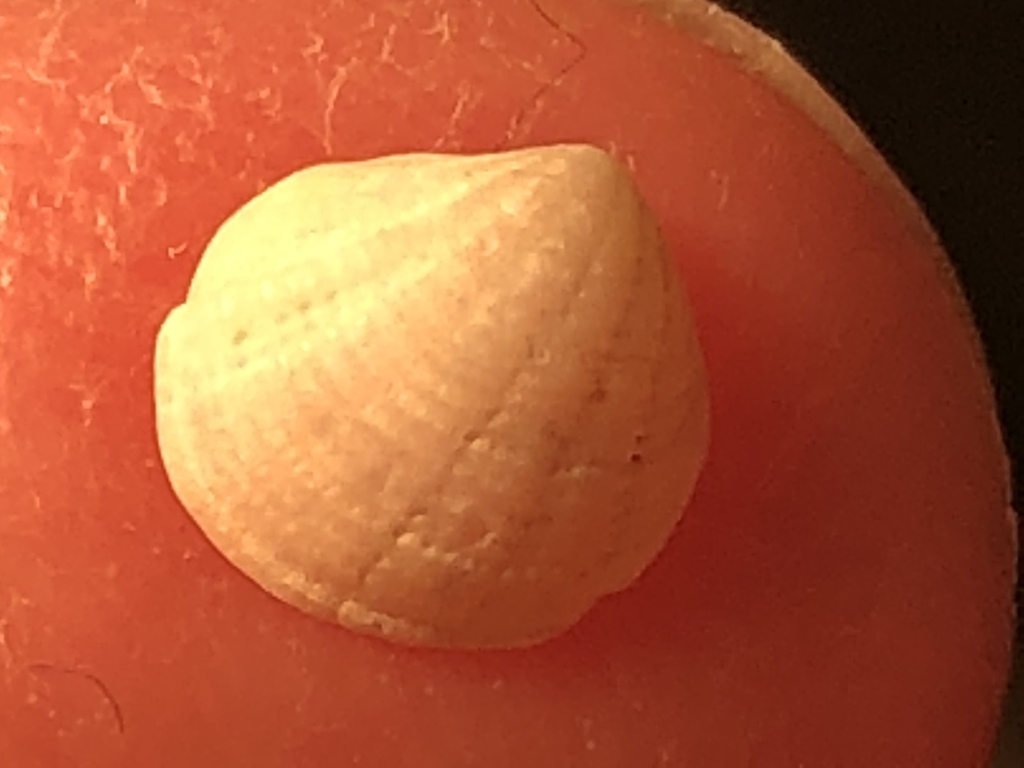 Radiolucina