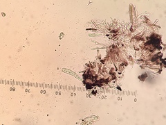 Bachmanniomyces punctum