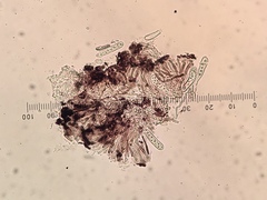Bachmanniomyces punctum