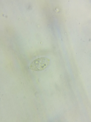 Macrotyphula contorta