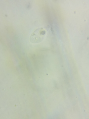 Macrotyphula contorta