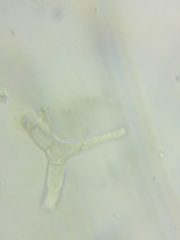 Macrotyphula contorta