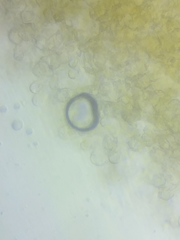 Macrotyphula contorta