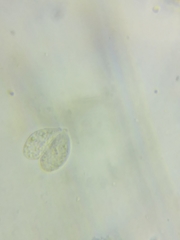 Macrotyphula contorta