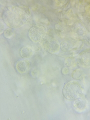 Macrotyphula contorta