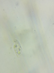 Macrotyphula contorta