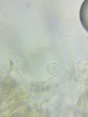 Macrotyphula contorta