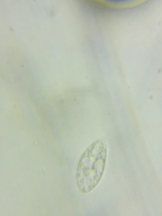 Macrotyphula contorta